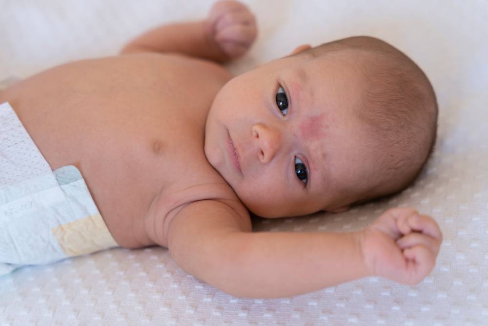 Diagnosing Common Skin Conditions in Babies and Children