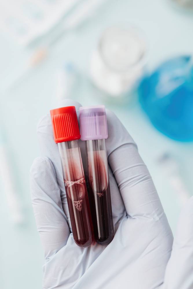 Understanding Blood Test Reference Ranges