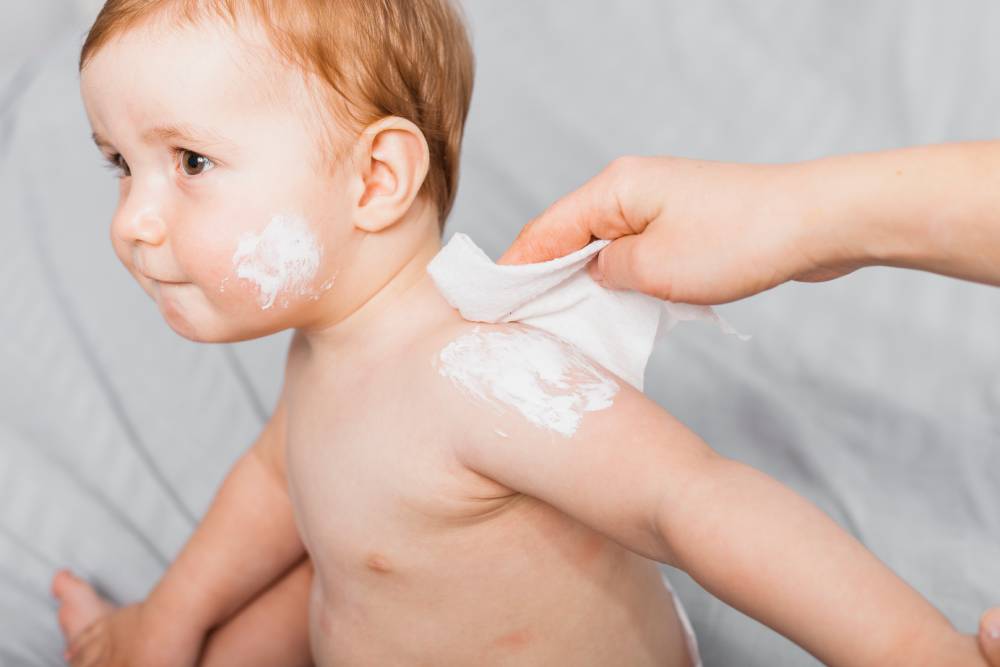 Understanding and Applying Emollients in Paediatric Eczema