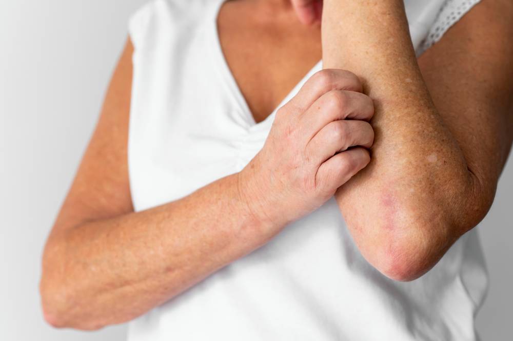 Understanding Common Fungal Skin Conditions in Primary Care