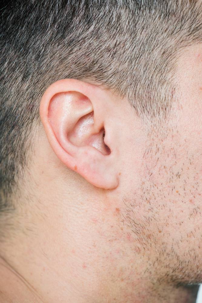 Navigating Otitis Externa